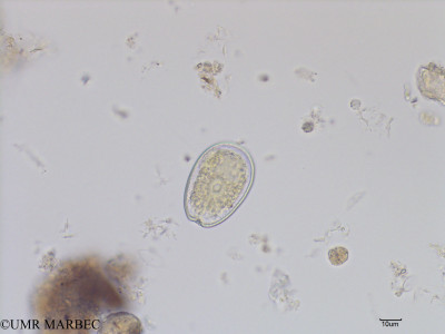 phyto/Bizerte/bizerte_bay/RISCO July 2016/Prorocentrum lima (Baie_T1C-cf Proro lima-2).tif(copy)_thumb.jpg